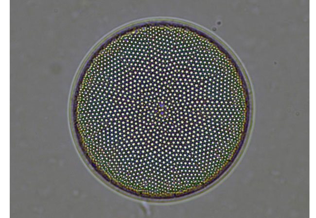 PB: Eine Mikrofotografie einer zentrischen Kieselalge aus dem Indischen Südozean aus dem Holozän. Dr. Anja Studer/MPIC