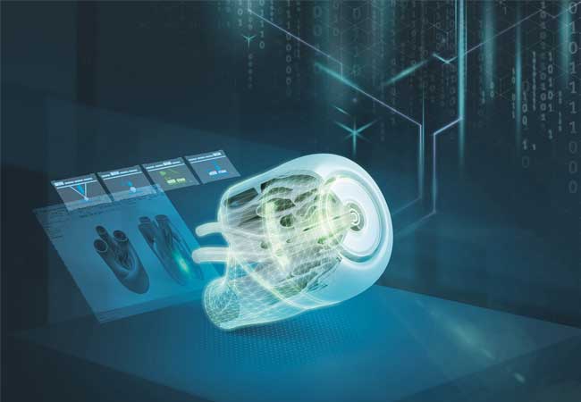 PB: Siemens vernetzt Gesundheitsorganisationen mit Designern und 3D-Druckern für Produktion medizinischer Komponenten